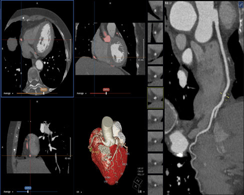 Germanium can be used in the manufacture of stereo imaging agents in medical diagnostics